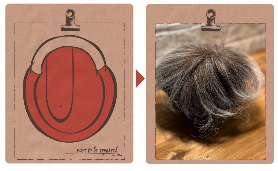 白髪増毛の修理